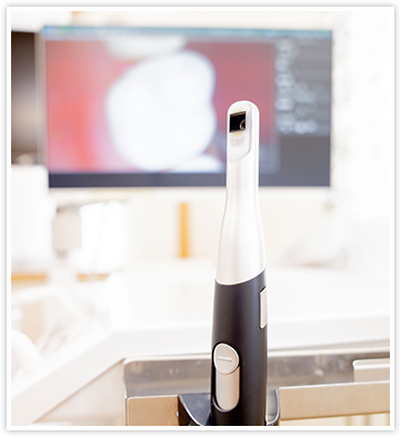 口腔内カメラの写真